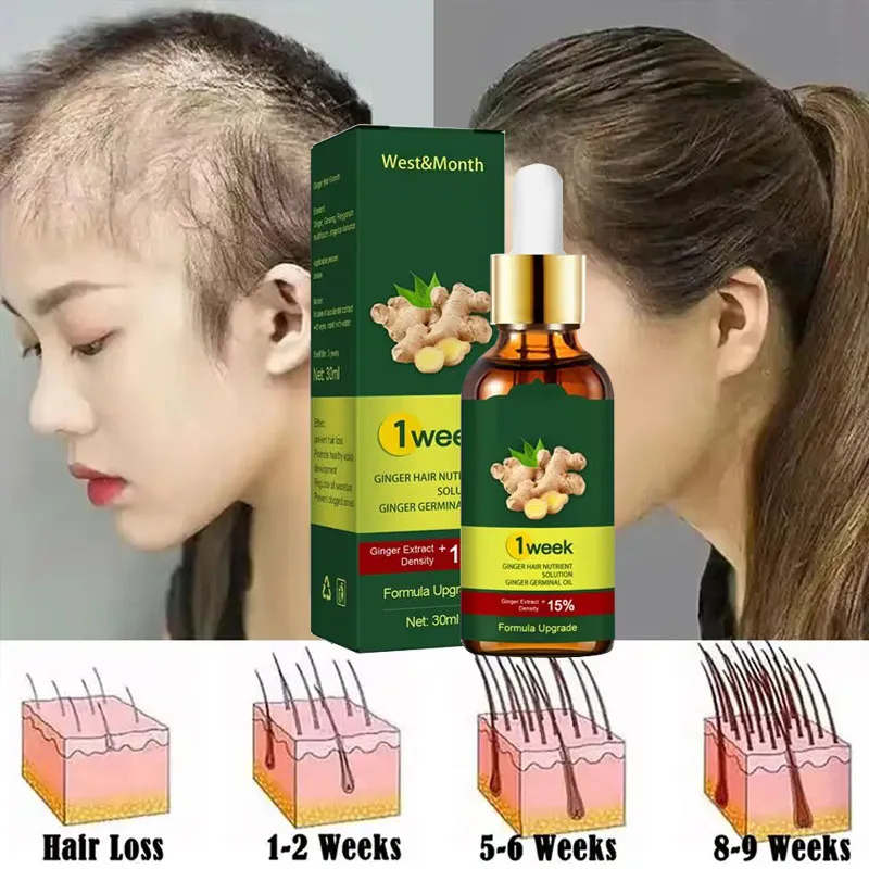 Licorice Root Sticks - Продукты для роста волос Ginger 7